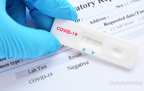 Negatywny test COVID-19 lub zaświadczenie o szczepieniu w 24h